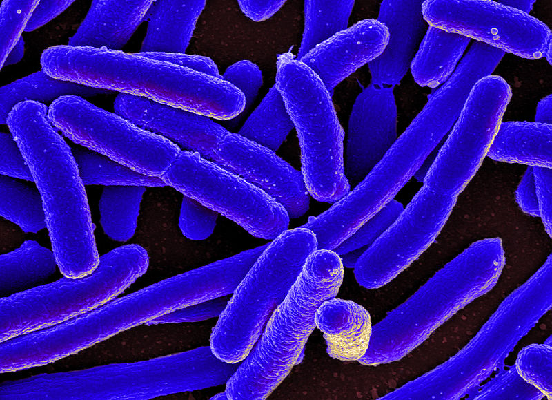 E. coli, uno de los agentes etiológicos de la sepsiis